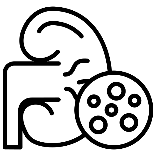 Urinary Stones
